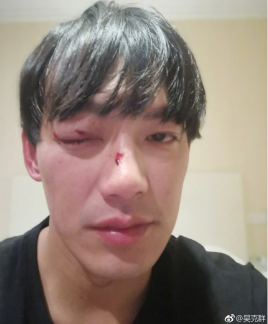 荷兰弗鲁默尤脚部受伤无法坚持场上的简单介绍